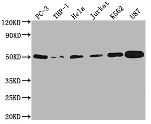Western Blot<br />Positive WB detected in: PC-3 whole cell lysate, THP-1 whole cell lysate, Hela whole cell lysate, Jurkat whole cell lysate, K562 whole cell lysate, U87 whole cell lysate<br />All lanes: PTPN1 antibody at 1:2000<br />Secondary<br />Goat polyclonal to rabbit IgG at 1/50000 dilution<br />Predicted band size: 50 kDa<br />Observed band size: 50 kDa<br />