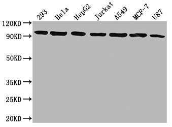 Western Blot<br />Positive WB detected in: 293 whole cell lysate, Hela whole cell lysate, HepG2 whole cell lysate, Jurkat whole cell lysate, A549 whole cell lysate, MCF-7 whole cell lysate, U87 whole cell lysate<br />All lanes: NR3C1 antibody at 1:1500<br />Secondary<br />Goat polyclonal to rabbit IgG at 1/50000 dilution<br />Predicted band size: 86, 83, 82, 77, 76, 65, 61, 52, 51, 50 kDa<br />Observed band size: 95 kDa<br />