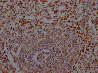 IHC image of CSB-RA200985A0HU diluted at 1:100 and staining in paraffin-embedded human spleen tissue performed on a Leica BondTM system. After dewaxing and hydration, antigen retrieval was mediated by high pressure in a citrate buffer (pH 6.0). Section was blocked with 10% normal goat serum 30min at RT. Then primary antibody (1% BSA) was incubated at 4℃ overnight. The primary is detected by a Goat anti-rabbit IgG polymer labeled by HRP and visualized using 0.05% DAB.