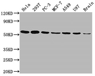 Western Blot<br />Positive WB detected in: Hela whole cell lysate, 293T whole cell lysate, PC-3 whole cell lysate, MCF-7 whole cell lysate, A549 whole cell lysate, U87 whole cell lysate, Brain tissue<br />All lanes: KLF4 antibody at 1:1500<br />Secondary<br />Goat polyclonal to rabbit IgG at 1/50000 dilution<br />Predicted band size: 55, 52, 46, 13, 7 kDa<br />Observed band size: 55 kDa<br />