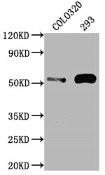 Western Blot<br />Positive WB detected in: COLO320 whole cell lysate, 293 whole cell lysate<br />All lanes: TP53 antibody at 1:2000<br />Secondary<br />Goat polyclonal to rabbit IgG at 1/50000 dilution<br />Predicted band size: 44, 38, 39, 40, 34, 35, 30, 24, 25 kDa<br />Observed band size: 53 kDa<br />