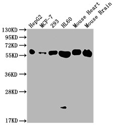 Western Blot<br />Positive WB detected in: HepG2 whole cell lysate, MCF-7 whole cell lysate, 293 whole cell lysate, HL60 whole cell lysate, Mouse Heart tissue, Mouse Brain tissue<br />All lanes: ATP5F1A antibody at 1:2000<br />Secondary<br />Goat polyclonal to rabbit IgG at 1/50000 dilution<br />Predicted band size: 60, 55, 58 kDa<br />Observed band size: 60 kDa<br />