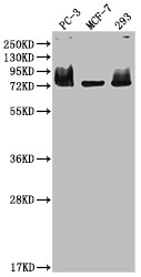 Western Blot<br />Positive WB detected in: PC-3 whole cell lysate, MCF-7 whole cell lysate, 293 whole cell lysate<br />All lanes: MEN1 antibody at 1:2000<br />Secondary<br />Goat polyclonal to rabbit IgG at 1/50000 dilution<br />Predicted band size: 69, 68, 64 kDa<br />Observed band size: 75 kDa<br />