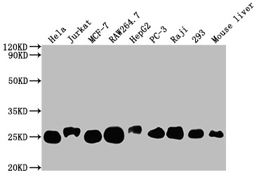 Western Blot<br />Positive WB detected in: Hela whole cell lysate, Jurkat whole cell lysate, MCF-7 whole cell lysate, RAW264.7 whole cell lysate, HepG2 whole cell lysate, PC-3 whole cell lysate, Raji whole cell lysate, 293 whole cell lysate, Mouse liver tissue<br />All lanes: TPT1 antibody at 1:2000<br />Secondary<br />Goat polyclonal to rabbit IgG at 1/50000 dilution<br />Predicted band size: 20, 16 kDa<br />Observed band size: 25 kDa<br />