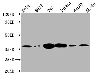 Western Blot<br />Positive WB detected in: Hela whole cell lysate, 293T whole cell lysate, 293 whole cell lysate, Jurkat whole cell lysate, HepG2 whole cell lysate, HL-60 whole cell lysate<br />All lanes: Thymidylate Synthase antibody at 1:2000<br />Secondary<br />Goat polyclonal to rabbit IgG at 1/50000 dilution<br />Predicted band size: 36, 32, 27 kDa<br />Observed band size: 36 kDa<br />