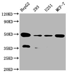 Western Blot<br />Positive WB detected in:HepG2 whole cell lysate, 293 whole cell lysate, U251 whole cell lysate, MCF-7 whole cell lysate<br />All lanes: UQCRC2 antibody at 1:2000<br />Secondary<br />Goat polyclonal to rabbit IgG at 1/50000 dilution<br />Predicted band size: 49 kDa<br />Observed band size: 49 kDa<br />