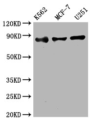 Western Blot<br />Positive WB detected in: K562 whole cell lysate, MCF-7 whole cell lysate, U251 whole cell lysate<br />All lanes: IKK beta antibody at 1:2000<br />Secondary<br />Goat polyclonal to rabbit IgG at 1/50000 dilution<br />Predicted band size: 87 kDa<br />Observed band size: 87 kDa<br />