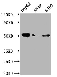 Western Blot<br />Positive WB detected in: HepG2 whole cell lysate, A549 whole cell lysate, K562 whole cell lysate<br />All lanes: Factor IX antibody at 1:2000<br />Secondary<br />Goat polyclonal to rabbit IgG at 1/50000 dilution<br />Predicted band size: 52 kDa<br />Observed band size: 52 kDa<br />