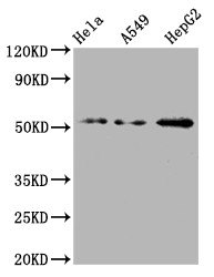 Western Blot<br />Positive WB detected in: Hela whole cell lysate, A549 whole cell lysate, HepG2 whole cell lysate<br />All lanes: CD47 antibody at 1:2000<br />Secondary<br />Goat polyclonal to rabbit IgG at 1/50000 dilution<br />Predicted band size: 36, 32, 34 kDa<br />Observed band size: 55 kDa<br />
