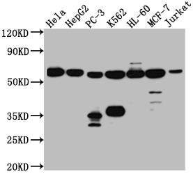 Western Blot<br />Positive WB detected in: Hela whole cell lysate, HepG2 whole cell lysate, PC-3 whole cell lysate, K562 whole cell lysate, HL-60 whole cell lysate, MCF-7 whole cell lysate, Jurkat whole cell lysate<br />All lanes: PTBP1 antibody at 1:1000<br />Secondary<br />Goat polyclonal to rabbit IgG at 1/50000 dilution<br />Predicted band size: 58, 60, 60 kDa<br />Observed band size: 58 kDa<br />