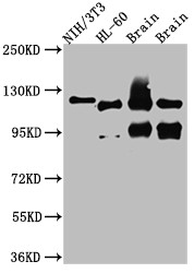 Western Blot<br />Positive WB detected in: NIH/3T3 whole cell lysate, HL-60 whole cell lysate, Rat Brain whole cell lysate, Mouse Brain whole cell lysate<br />All lanes: OGT antibody at 1:1000<br />Secondary<br />Goat polyclonal to rabbit IgG at 1/50000 dilution<br />Predicted band size: 117, 104, 116, 75 kDa<br />Observed band size: 117 kDa<br />