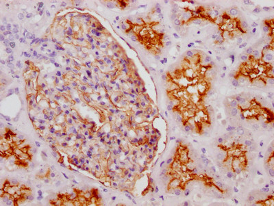 IHC image of CSB-RA187479A0HU diluted at 1:100 and staining in paraffin-embedded human kidney tissue performed on a Leica BondTM system. After dewaxing and hydration, antigen retrieval was mediated by high pressure in a citrate buffer (pH 6.0). Section was blocked with 10% normal goat serum 30min at RT. Then primary antibody (1% BSA) was incubated at 4℃ overnight. The primary is detected by a Goat anti-rabbit IgG polymer labeled by HRP and visualized using 0.05% DAB.