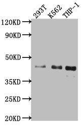 Western Blot<br />Positive WB detected in: 293T whole cell lysate, K562 whole cell lysate, THP-1 whole cell lysate<br />All lanes: Islet1 antibody at 1:1000<br />Secondary<br />Goat polyclonal to rabbit IgG at 1/50000 dilution<br />Predicted band size: 40 kDa<br />Observed band size: 40 kDa<br />