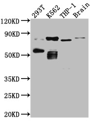 Western Blot<br />Positive WB detected in: 293T whole cell lysate, K562 whole cell lysate, THP-1 whole cell lysate, Mouse Brain whole cell lysate<br />All lanes: PKC antibody at 1:1000<br />Secondary<br />Goat polyclonal to rabbit IgG at 1/50000 dilution<br />Predicted band size: 82, 75, 68 kDa<br />Observed band size: 82, 55 kDa<br />