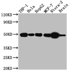Western Blot<br />Positive WB detected in: THP-1 whole cell lysate, Hela whole cell lysate, HepG2 whole cell lysate, MCF-7 whole cell lysate, Ntera-2 whole cell lysate, Mouse Brain whole cell lysate<br />All lanes: TACR1 antibody at 1:1000<br />Secondary<br />Goat polyclonal to rabbit IgG at 1/50000 dilution<br />Predicted band size: 47, 36 kDa<br />Observed band size: 50 kDa<br />