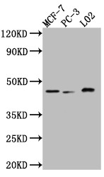 Western Blot<br />Positive WB detected in: MCF-7 whole cell lysate, PC-3 whole cell lysate, L02 whole cell lysate<br />All lanes: p38 antibody at 1:1000<br />Secondary<br />Goat polyclonal to rabbit IgG at 1/50000 dilution<br />Predicted band size: 42, 42, 35, 36 kDa<br />Observed band size: 42 kDa<br />