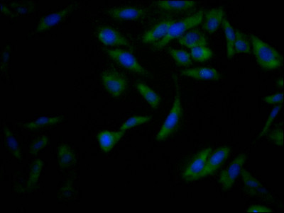 Immunofluorescence staining of Hela Cells with CSB-RA225569A0HU at 1:50, counter-stained with DAPI. The cells were fixed in 4% formaldehyde, permeated by 0.2% TritonX-100, and blocked in 10% normal Goat Serum. The cells were then incubated with the antibody overnight at 4℃. Nuclear DNA was labeled in blue with DAPI. The secondary antibody was FITC-conjugated AffiniPure Goat Anti-Rabbit IgG (H+L).