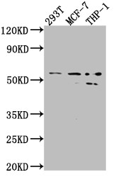 Western Blot<br />Positive WB detected in: 293T whole cell lysate, MCF-7 whole cell lysate, THP-1 whole cell lysate<br />All lanes: MMP12 antibody at 1:1000<br />Secondary<br />Goat polyclonal to rabbit IgG at 1/50000 dilution<br />Predicted band size: 55 kDa<br />Observed band size: 54, 45 kDa<br />