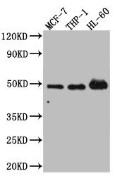 Western Blot<br />Positive WB detected in: MCF-7 whole cell lysate, THP-1 whole cell lysate, HL-60 whole cell lysate<br />All lanes: Vitamin D antibody at 1:1000<br />Secondary<br />Goat polyclonal to rabbit IgG at 1/50000 dilution<br />Predicted band size: 49, 54 kDa<br />Observed band size: 49 kDa<br />