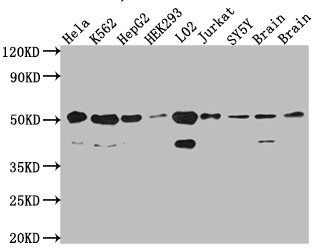 Western Blot<br />Positive WB detected in: Hela whole cell lysate, K562 whole cell lysate, HepG2 whole cell lysate, HEK293 whole cell lysate, L02 whole cell lysate, Jurkat whole cell lysate, SH-SY5Y whole cell lysate, Mouse Brain whole cell lysate, Rat Brain cell lysate<br />All lanes: RbAp48 antibody at 1:1000<br />Secondary<br />Goat polyclonal to rabbit IgG at 1/50000 dilution<br />Predicted band size: 48, 48, 47, 44 kDa<br />Observed band size: 53, 40 kDa<br />