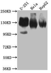 Western Blot<br />Positive WB detected in: U-251 whole cell lysate, Hela whole cell lysate, HepG2 whole cell lysate<br />All lanes: ITGAV antibody at 1:1000<br />Secondary<br />Goat polyclonal to rabbit IgG at 1/50000 dilution<br />Predicted band size: 117, 113, 112 kDa<br />Observed band size: 130 kDa<br />