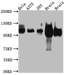 Western Blot<br />Positive WB detected in: Hela whole cell lysate, A375 whole cell lysate, HEK293 whole cell lysate, Rat Brain whole cell lysate, Mouse Brain whole cell lysate<br />All lanes: Amyloid beta A4 antibody at 1:1000<br />Secondary<br />Goat polyclonal to rabbit IgG at 1/50000 dilution<br />Predicted band size: 87, 35, 77, 79, 79, 81, 83, 85, 86, 73, 85 kDa<br />Observed band size: 100 kDa<br />