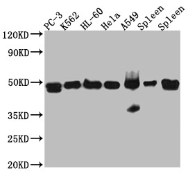 Western Blot<br />Positive WB detected in: PC-3 whole cell lysate, K562 whole cell lysate, HL-60 whole cell lysate, A549 whole cell lysate, Mouse Spleen whole cell lysate, Rat Spleen whole cell lysate<br />All lanes: Arp3 Antibody at 1:1000<br />Secondary<br />Goat polyclonal to rabbit IgG at 1/50000 dilution<br />Predicted band size: 48 kDa<br />Observed band size: 48 kDa<br />