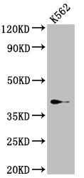 Western Blot<br />Positive WB detected in: K562 whole cell lysate<br />All lanes: SAE1 Antibody at 1:1000<br />Secondary<br />Goat polyclonal to rabbit IgG at 1/50000 dilution<br />Predicted band size: 39, 30, 34 kDa<br />Observed band size: 39 kDa<br />