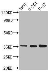 Western Blot<br />Positive WB detected in: 293T whole cell lysate, U-251 whole cell lysate, U-87 whole cell lysate<br />All lanes: Osteopontin Antibody at 1:1000<br />Secondary<br />Goat polyclonal to rabbit IgG at 1/50000 dilution<br />Predicted band size: 36, 34, 33, 34, 34 kDa<br />Observed band size: 36 kDa<br />