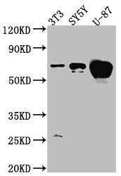 Western Blot<br />Positive WB detected in: NIH/3T3 whole cell lysate, SH-SY5Y whole cell lysate, U-87 whole cell lysate<br />All lanes: Estrogen Receptor alpha antibody at 1:1000<br />Secondary<br />Goat polyclonal to rabbit IgG at 1/50000 dilution<br />Predicted band size: 67, 54, 48, 36 kDa<br />Observed band size: 67 kDa<br />