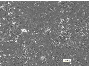Adipose tissue-derived mesenchymal stem/stromal cells