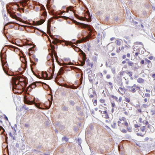 Immunohistochemical staining of human kidney shows strong membranous and/or moderate cytoplasmic immunoreactivity in subsets of renal tubules, while glomeruli are negative.