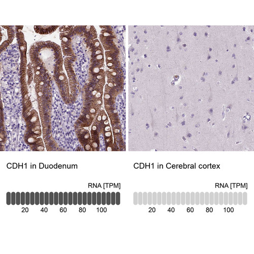 Immunohistochemistry analysis in human duodenum and cerebral cortex tissues using AMAb90862 antibody. Corresponding CDH1 RNA-seq data are presented for the same tissues.