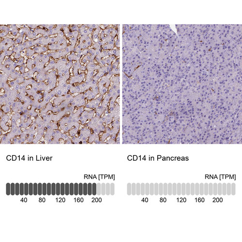 Immunohistochemistry analysis in human liver and pancreas tissues using AMAb90897 antibody. Corresponding CD14 RNA-seq data are presented for the same tissues.