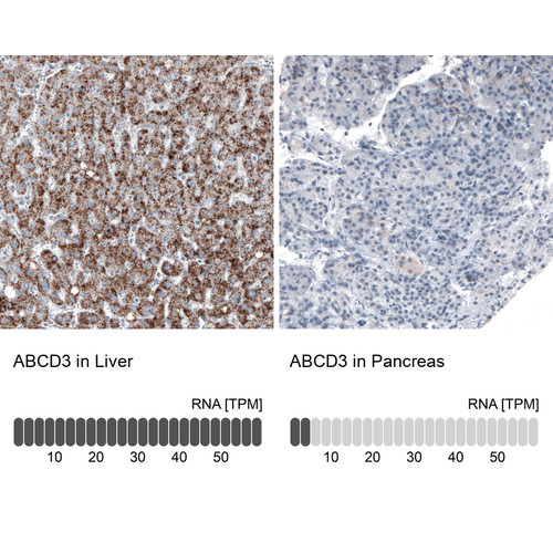 Immunohistochemistry analysis in human liver and pancreas tissues using AMAb90995 antibody. Corresponding ABCD3 RNA-seq data are presented for the same tissues.
