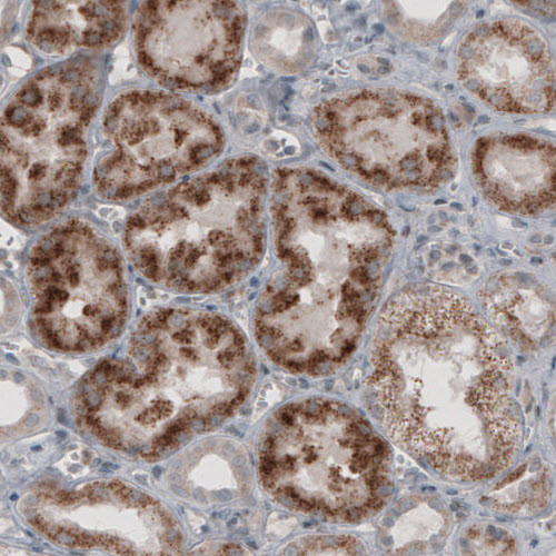 Immunohistochemical staining of human kidney shows granular cytoplasmic immunoreactivity in renal tubules.