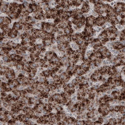 Immunohistochemical staining of human liver shows strong granular cytoplasmic positivity in hepatocytes.