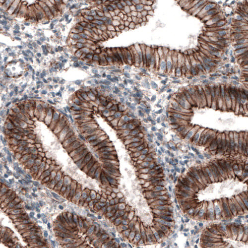 Immunohistochemical staining of human endometrium shows strong membranous immunoreactivity in glandular epithelium.