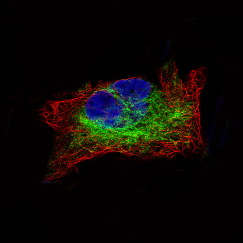 Immunofluorescence staining of RH-30 cells using the Anti-DES monoclonal antibody, showing specific staining in intermediate filaments in green. Microtubule- and nuclear probes are visualized in red and blue, respectively (where available).