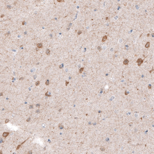 Immunohistochemical staining of human cerebral cortex shows moderate cytoplasmic positivity in neurons.