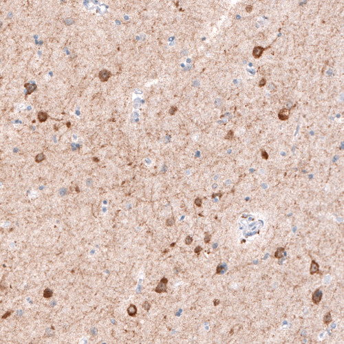 Immunohistochemical staining of cerebral cortex shows strong cytoplasmic immunoreactivity in neurons.