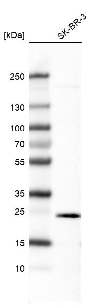 Western blot analysis in human cell line SK-BR-3.