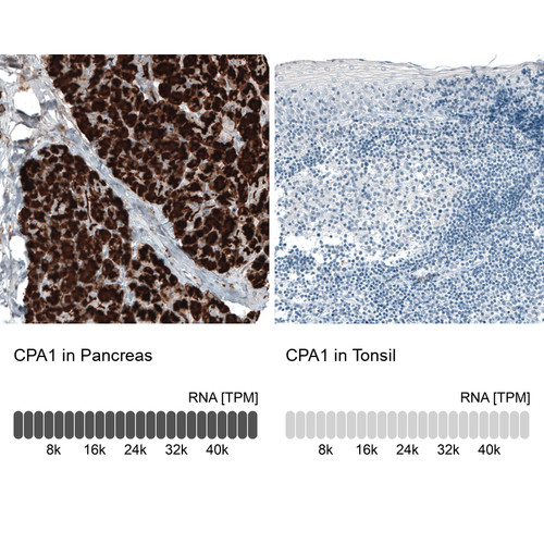 Immunohistochemistry analysis in human pancreas and tonsil tissues using AMAb91434 antibody. Corresponding CPA1 RNA-seq data are presented for the same tissues.