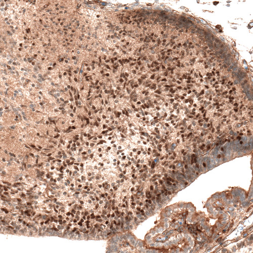 Immunohistochemical staining of mouse embryo E14 shows moderate nuclear positivity in neuronal cells in the developing cerebellum.