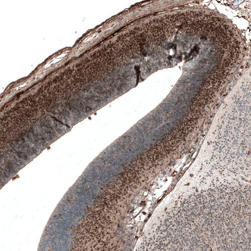Immunohistochemical staining of mouse embryo E14 shows moderate nuclear positivity in neuronal cells in developing cortex.