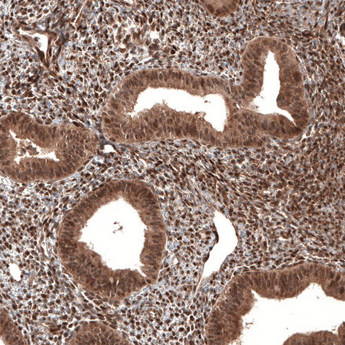 Immunohistochemical staining of human endometrium shows strong nuclear positivity in cells in endometrial stroma.