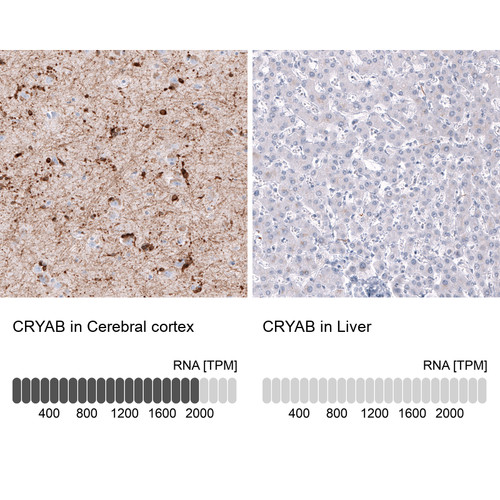 Immunohistochemistry analysis in human cerebral cortex and liver tissues using AMAb91661 antibody. Corresponding CRYAB RNA-seq data are presented for the same tissues.