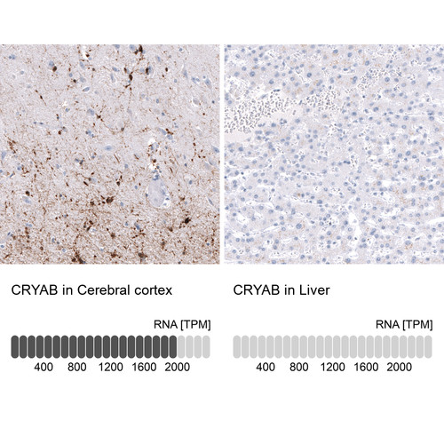 Immunohistochemistry analysis in human cerebral cortex and liver tissues using AMAb91662 antibody. Corresponding CRYAB RNA-seq data are presented for the same tissues.