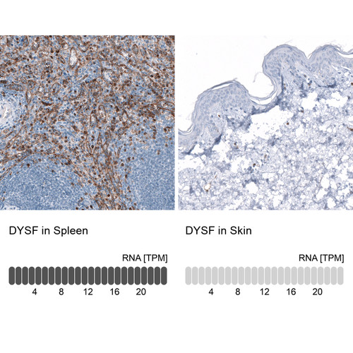Immunohistochemistry analysis in human spleen and skin tissues using AMAb91667 antibody. Corresponding DYSF RNA-seq data are presented for the same tissues.
