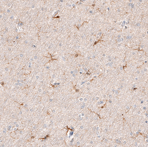 Immunohistochemical staining of human cerebral cortex shows moderate cytoplasmic positivity in microglia.